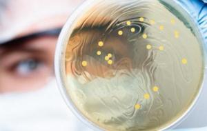 ما هي بكتيريا اللاكتوباسيلس؟