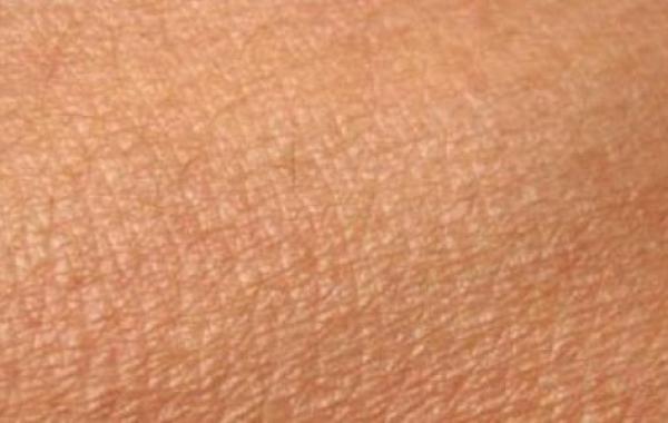 ما سبب جفاف الجلد
