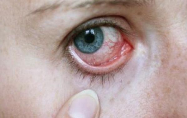 أعراض مرض شبكية العين