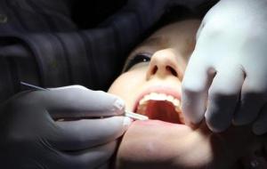 أضرار بنج الأسنان على الحامل