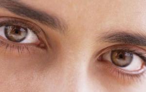 ما هو سبب ظهور الهالات السوداء تحت العين