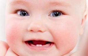 متى تظهر الأسنان عند الرضع