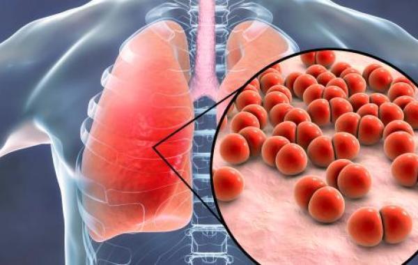 أسباب التهاب الرئة