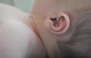 التهاب الأذن للرضع