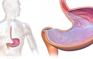 كيف يتم تشخيص الإرتجاع المريئي - فيديو
