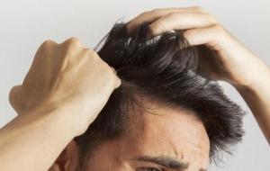 أسباب ظهور قشرة الشعر وعلاجها