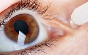كيف أتخلص من حساسية العين