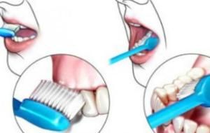 أهمية تنظيف الأسنان
