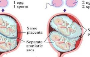 مراحل نمو التوائم في بطن الأم