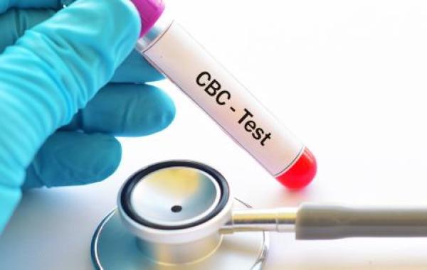 تحليل Cbc يكشف الإيدز