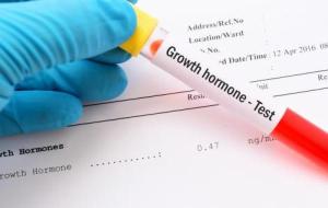 تحليل هرمون النمو