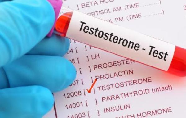 كيفية معرفة نسبة هرمون التستوستيرون