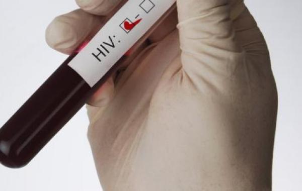 ما هو تحليل Hiv