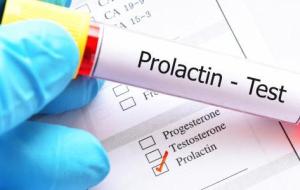 ما هو تحليل Prolactin