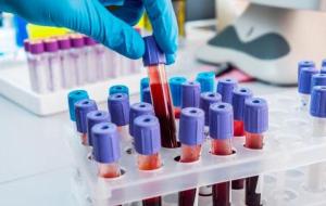 ما هو تحليل غازات الدم