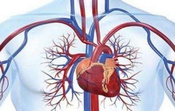 اضطراب الدورة الدموية