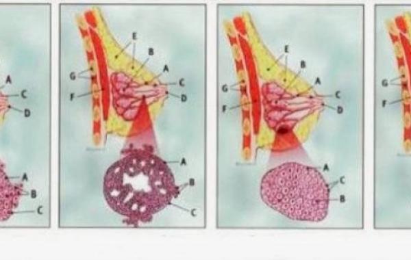 طريقة انتشار سرطان الثدي لباقي الجسم