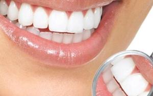 فوائد الملح للأسنان