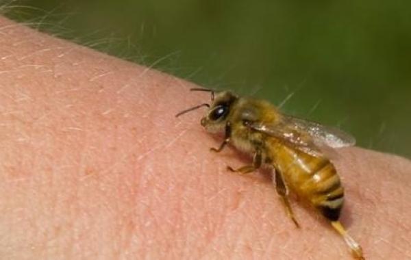 فوائد لسعات النحل