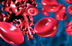 تخثر الدم - الجلطة الوريدية