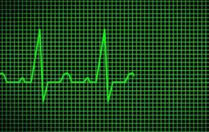 ما هو علاج ضربات القلب السريعة