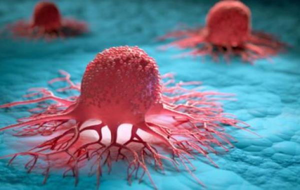 ما هي الخلايا السرطانية؟