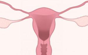 أضرار ربط الرحم لمنع الحمل