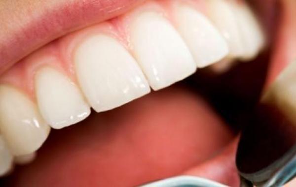 كيفية إزالة التسوس من الأسنان طبيعياً