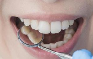 أعراض التهاب اللثة والأسنان