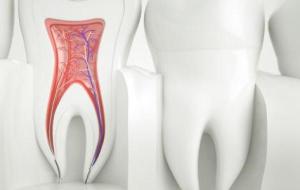 ما هو عصب الأسنان