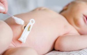 التهاب سرة الطفل حديث الولادة
